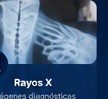 Rayos X